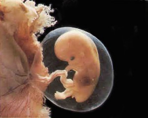 weeks151