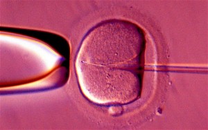 ivf_2606686b