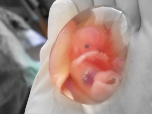 800px-human_fetus_10_weeks_-_therapeutic_abortion1