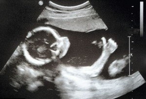 ultrasound3d10