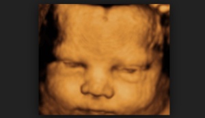 ultrasound4d56