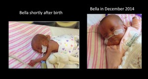 Bella-Davison-born-23-weeks-gestation-needs-oxygen
