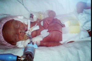PA-REAL-LIFE-4-Jackie-Knowles-Anais-in-hospitalJPG