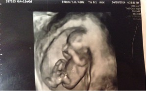 ultrasound3d18