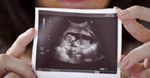 ultrasound3d20