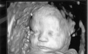 ultrasound4d38
