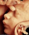 Новые 3D-технологии ультразвука позволяют увидеть ясное изображение ребенка в утробе матери