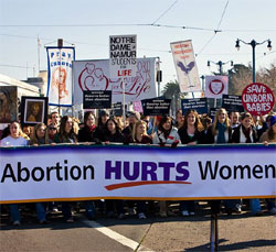 Исследование: законодательный запрет абортов не приводит к увеличению материнской смертности