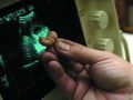 Абортов больше не будет: все врачи одной из польских клиник отказались их совершать