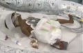 Ребёнок выжил чудесным образом после самопроизвольного аборта в 23 недели беременности