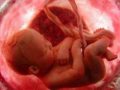 В Беларуси отменили ряд медицинских показаний для проведения абортов