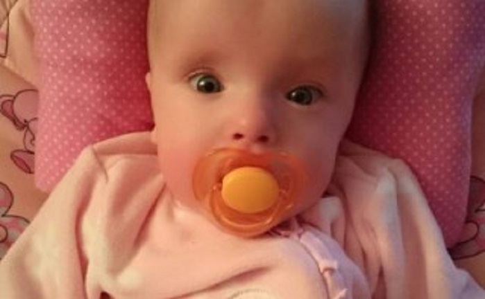 Ребенок, рожденный в 23 недели, чью фотографию публиковали, чтобы прекратить аборты на поздних сроках, чувствует себя хорошо