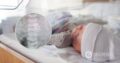 В Израиле родился ребенок с эмбрионом в животе
