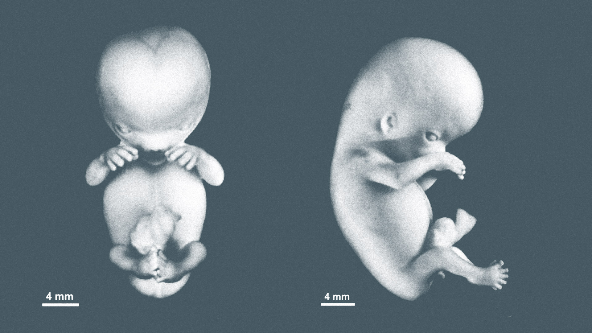 Уорд Кишер. Искажение науки об эмбрионе человека