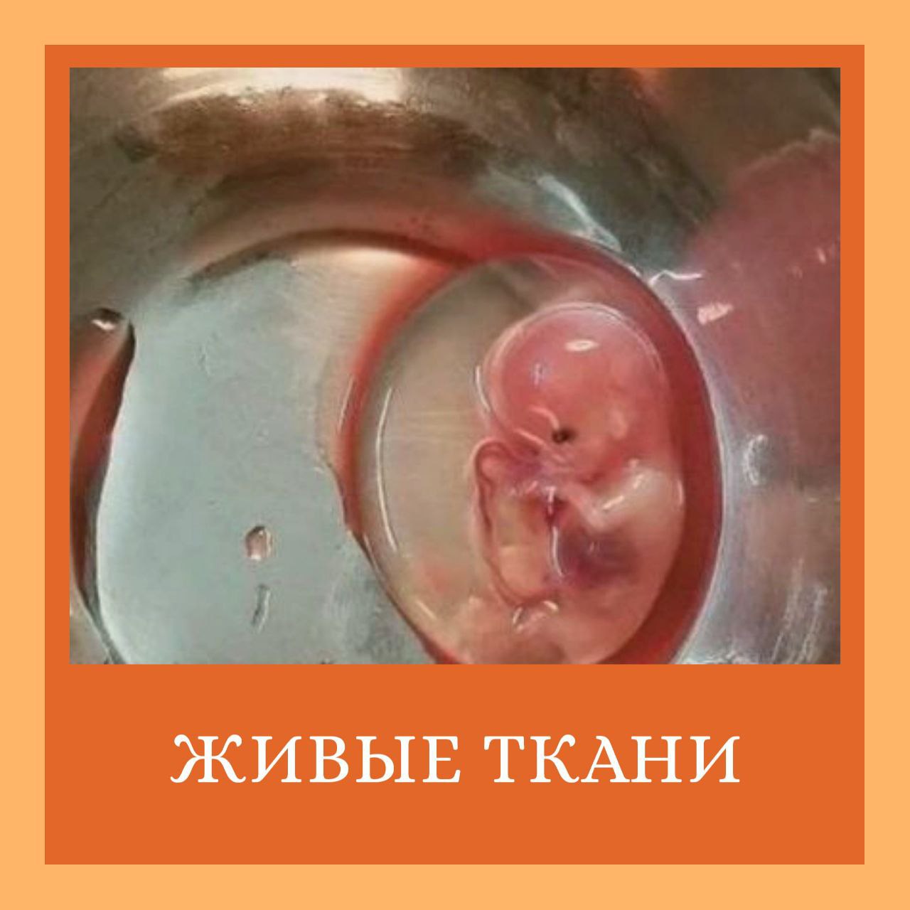 Евгенические аборты, феминицид и научные эксперименты