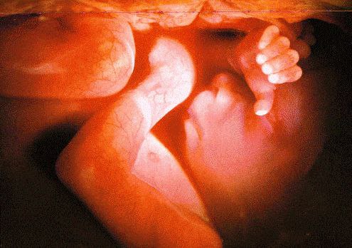 Женщина инициировала искусственные роды на 27 неделе и оставила ребёнка умирать