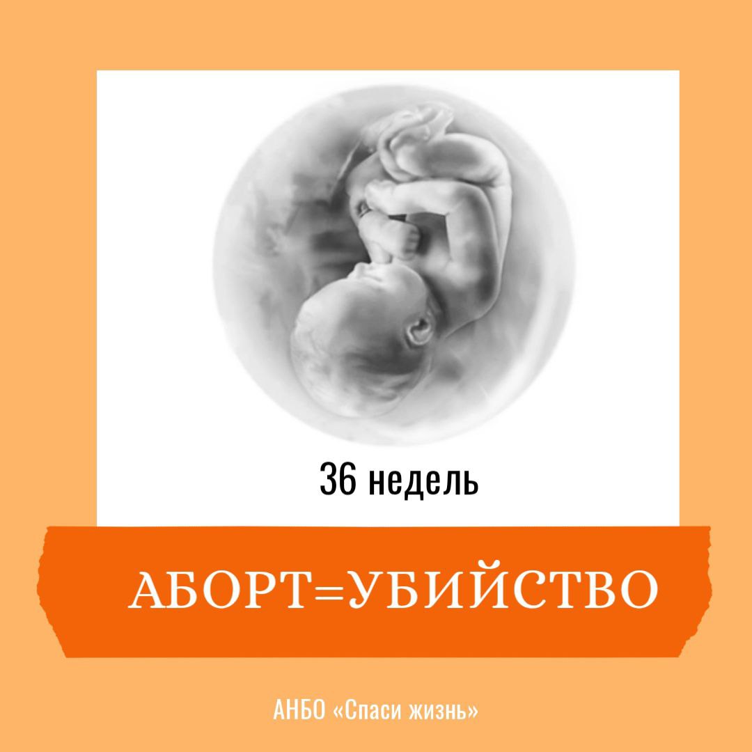 Убийство ребёнка — это аборт. А аборт — это убийство ребёнка.