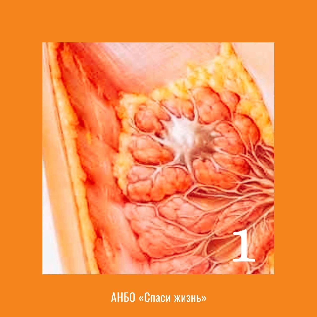ОБЗОР ПОСЛЕДСТВИЙ АБОРТОВ ПО ДАННЫМ НАУЧНЫХ ПУБЛИКАЦИЙ